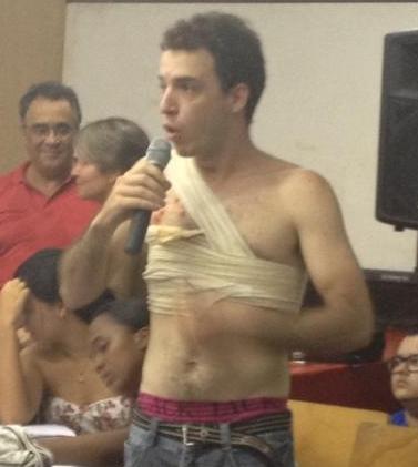 Caiubi est&aacute; com v&aacute;rios ferimentos no peito - Foto: Yuri Ramires