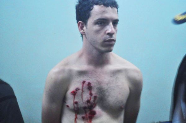 Estudante da UFMT foi ferido durante a&ccedil;&atilde;o da Pol&iacute;cia Militar - Foto: Jardel P. Arruda 