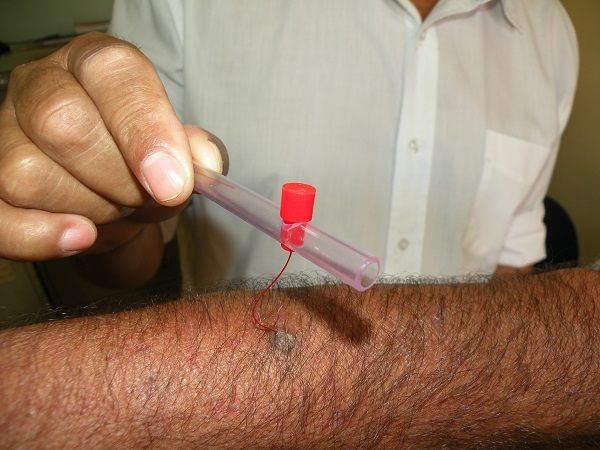 Acadêmicos terão contato com o progra,ma de controle da hanseníase. Foto: assessoria