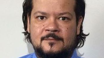 Cuiabá já utiliza nova técnica para tratar câncer no sistema nervoso central