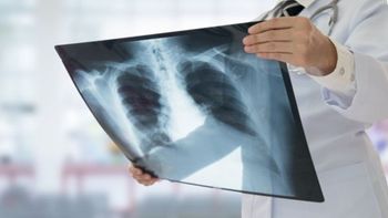 A cada 39 segundos pneumonia mata uma criança de até 5 anos 