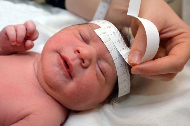 Balanço mostra que Mato Grosso registrou 293 casos de microcefalia