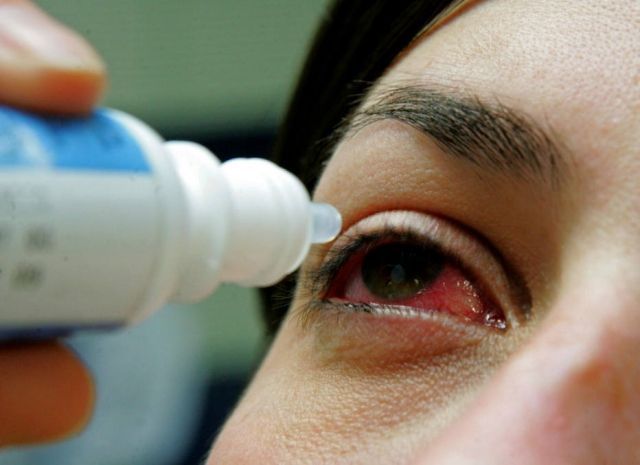 Vigilância Epidemiológica auxilia municípios e alerta a população