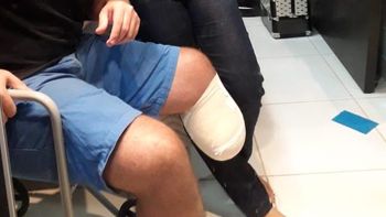 Jovem mato-grossense pede ajuda na internet para custeio de prótese