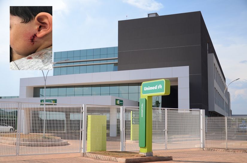 Equipe da Unimed dá pontos com galhos de árvore dentro da face de criança de 4 anos