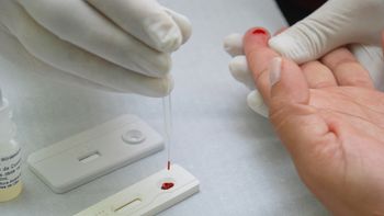 Em Salvador, testes rápidos diagnosticam 15 casos de HIV