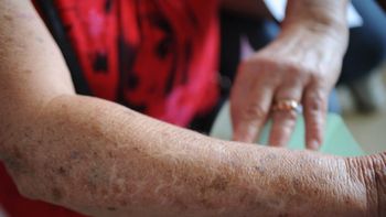 Brasil deve ter 600 mil novos casos de câncer por ano em 2018 e 2019