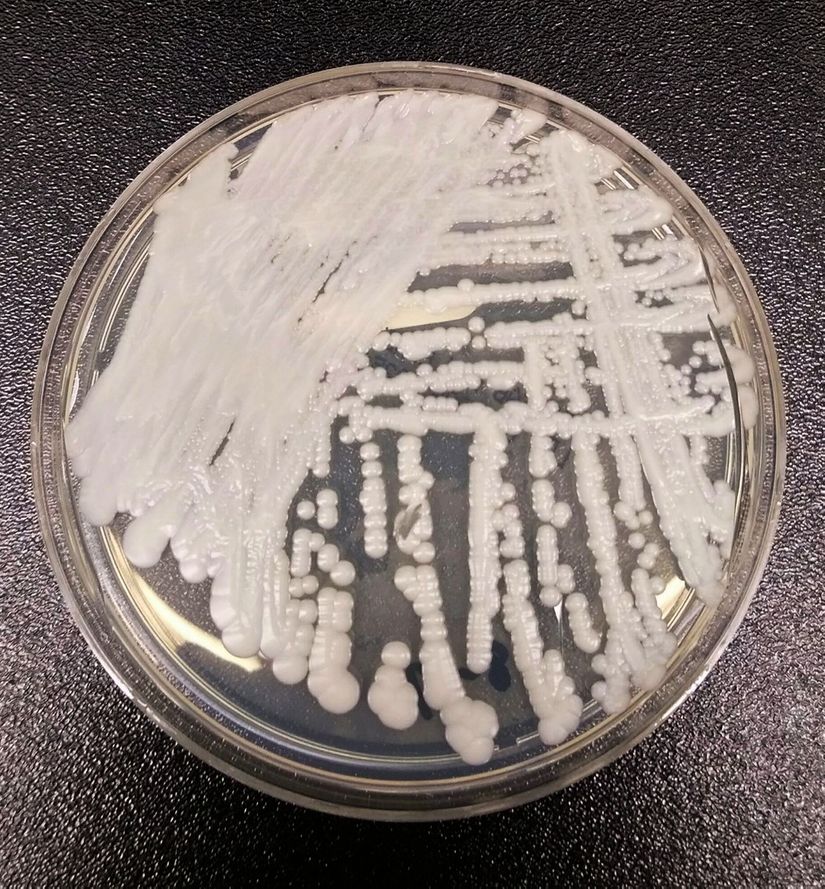 O mapa que mostra avanço no mundo de fungo resistente