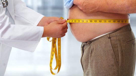 Obesidade e sobrepeso terão primeiro Protocolo Clínico para tratamento