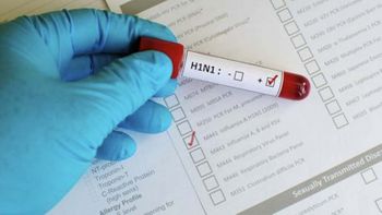 Secretaria Municipal de Saúde emite alerta sobre Influenza