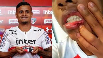 Mato-grossense denuncia jogador do São Paulo por agressão e faz postagem na internet 