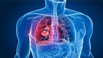 Estudo revela compostos que podem combater a tuberculose