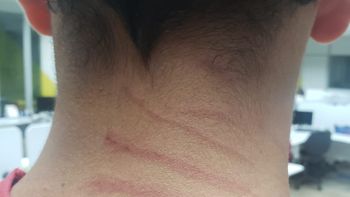 Homem é agredido ao tentar comprar em farmácia de Rondonópolis