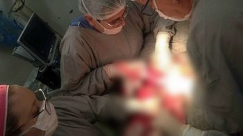 Como combater a epidemia de cesáreas no Brasil?