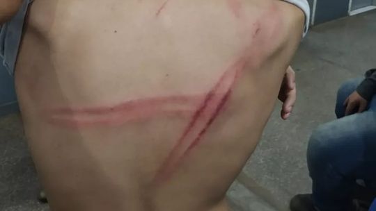 Padastro espanca enteado após tentar atropelá-lo enquanto jogava bola