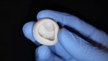Cientistas dos EUA imprimem válvula de coração 3D feita de colágeno