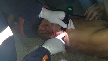 Em pleno feriado Polícia registra tentativa de homicídio com golpes de faca