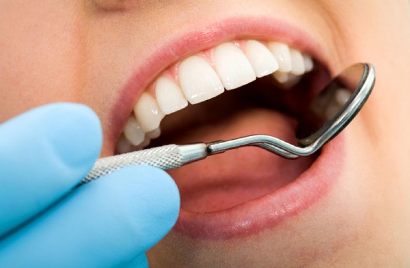 Saúde Bucal capacita odontologia da Atenção Básica para diagnóstico precoce de câncer de boca
