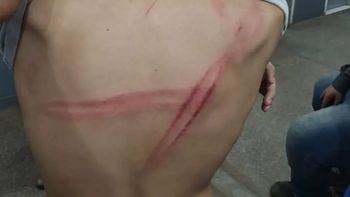 Padastro espanca enteado após tentar atropelá-lo enquanto jogava bola