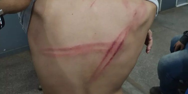 Padastro espanca enteado após tentar atropelá-lo enquanto jogava bola