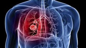 Nesta segunda tem pit stop de combate à tuberculose