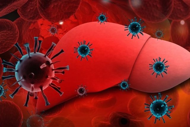 Hepatite A: saiba como se pega o vírus, quais são os sintomas e tratamentos