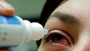 Vigilância Epidemiológica auxilia municípios e alerta a população