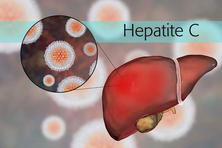 Saúde lança plano para eliminar hepatite C