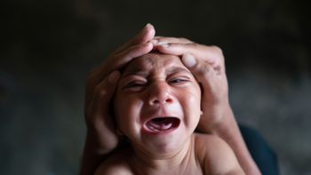 Mato Grosso registra novos casos de microcefalia