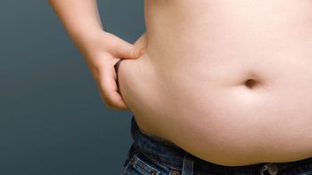 Obesidade pode ser prevenida na infância