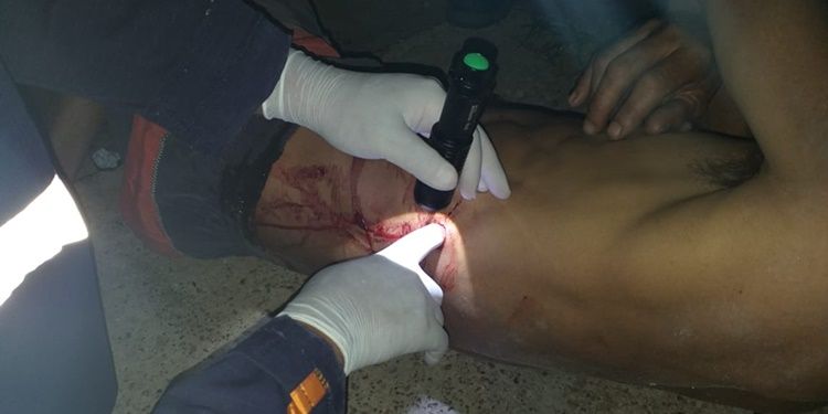 Em pleno feriado Polícia registra tentativa de homicídio com golpes de faca