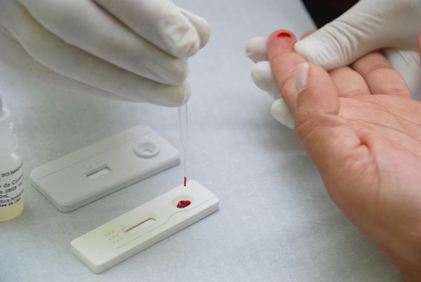 Em Salvador, testes rápidos diagnosticam 15 casos de HIV
