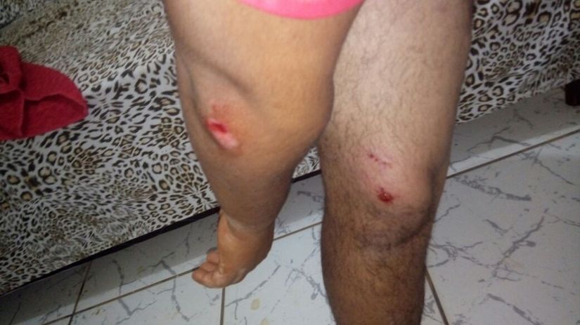 Trecho não terminado acima da Ponte da Lions leva motoqueiro, literalmente, para o buraco