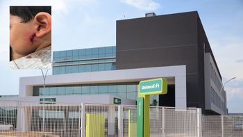 Equipe da Unimed dá pontos com galhos de árvore dentro da face de criança de 4 anos 