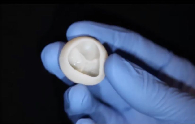 Cientistas dos EUA imprimem válvula de coração 3D feita de colágeno
