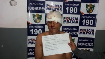 Roubo termina com criminoso espancado e preso em Várzea Grande 