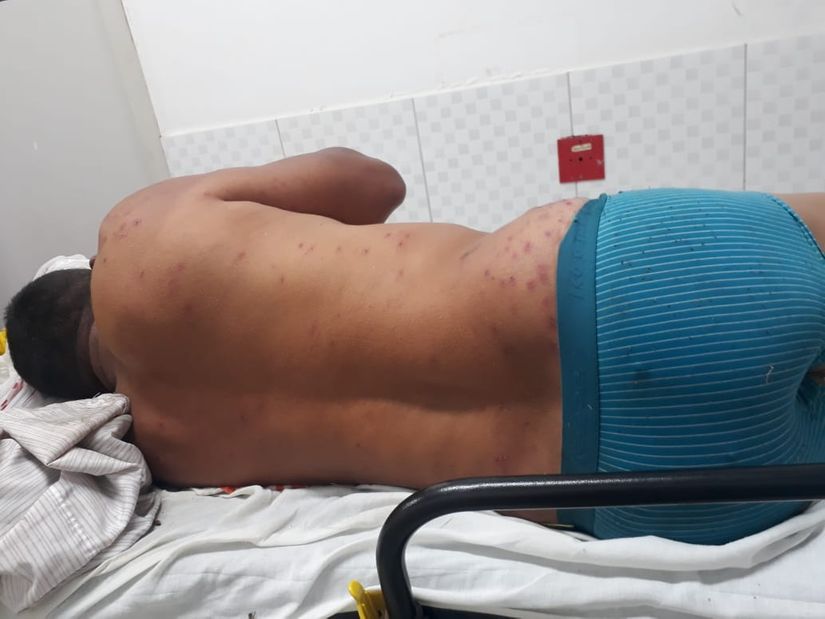 Homem foi picado mais de 300 vezes. (Foto: Divulgação)