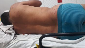 Homem foi picado mais de 300 vezes. (Foto: Divulgação)
