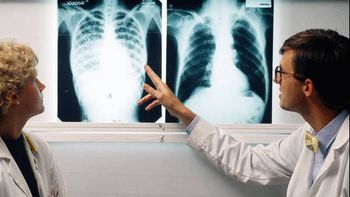 Saúde faz mutirão de exame da tuberculose neste sábado (23) na Praça dos Carreiros
