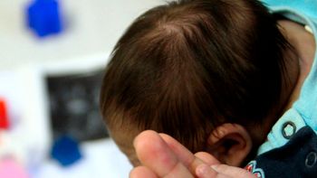 Notificações de casos suspeitos de microcefalia aumentam em Mato Grosso