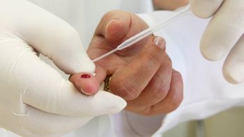 Enfermeiros da Santa Casa recebem capacitação em teste rápido de HIV