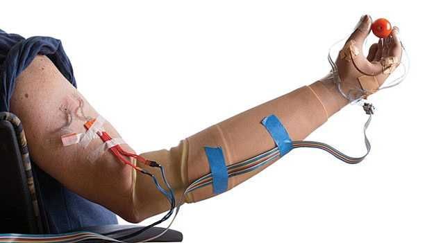 Cientistas desenvolvem braço biônico que devolve sensação de tato a amputados