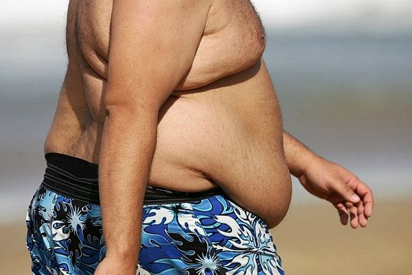 Obesidade quadruplica em países em desenvolvimento, diz relatório