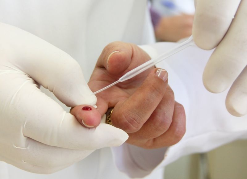 Enfermeiros da Santa Casa recebem capacitação em teste rápido de HIV