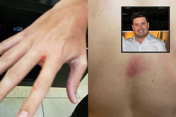 Reprodução Olhar Direto