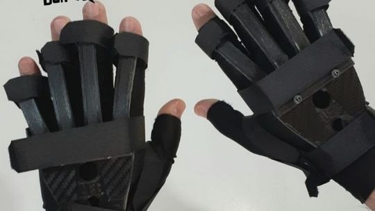 Luvas biônicas desenvolvidas pelo Ubiratan Bizarro - Foto: arquivo pessoal