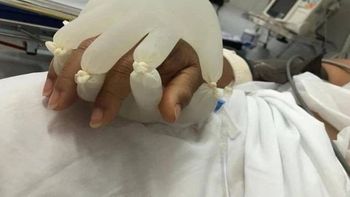 Foto da técnica da mãozinha compartilhada pelo diretor da OMS - Foto: reprodução / Twitter