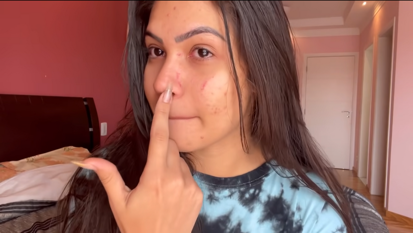 Reprodução