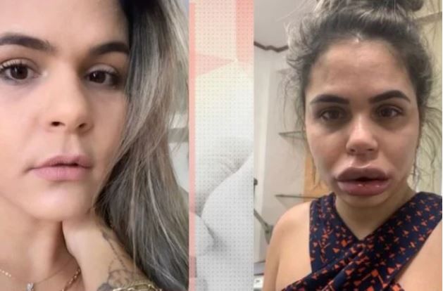 Reprodução
