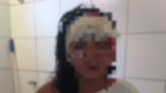 Reprodução